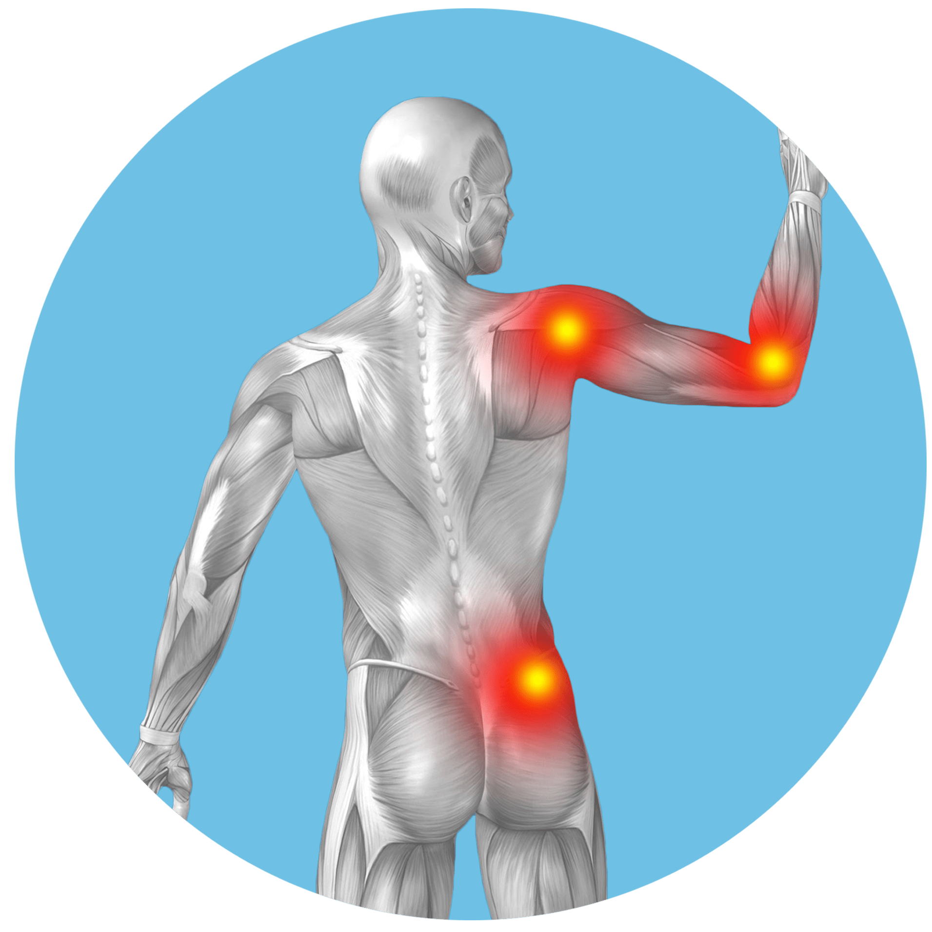 Ilustrace lidského těla zezadu s červeně zvýrazněnými oblastmi ukazujícími místa bolesti v rameni, dolní části zad a lokti