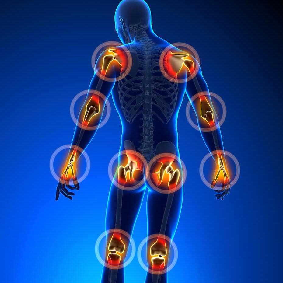 Série ilustrací zobrazujících bolest v různých částech těla, včetně kolene, lokte, záda a ramene, ve fluorescenční modré a oranžové barvě.